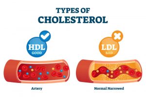 LDL and HDL