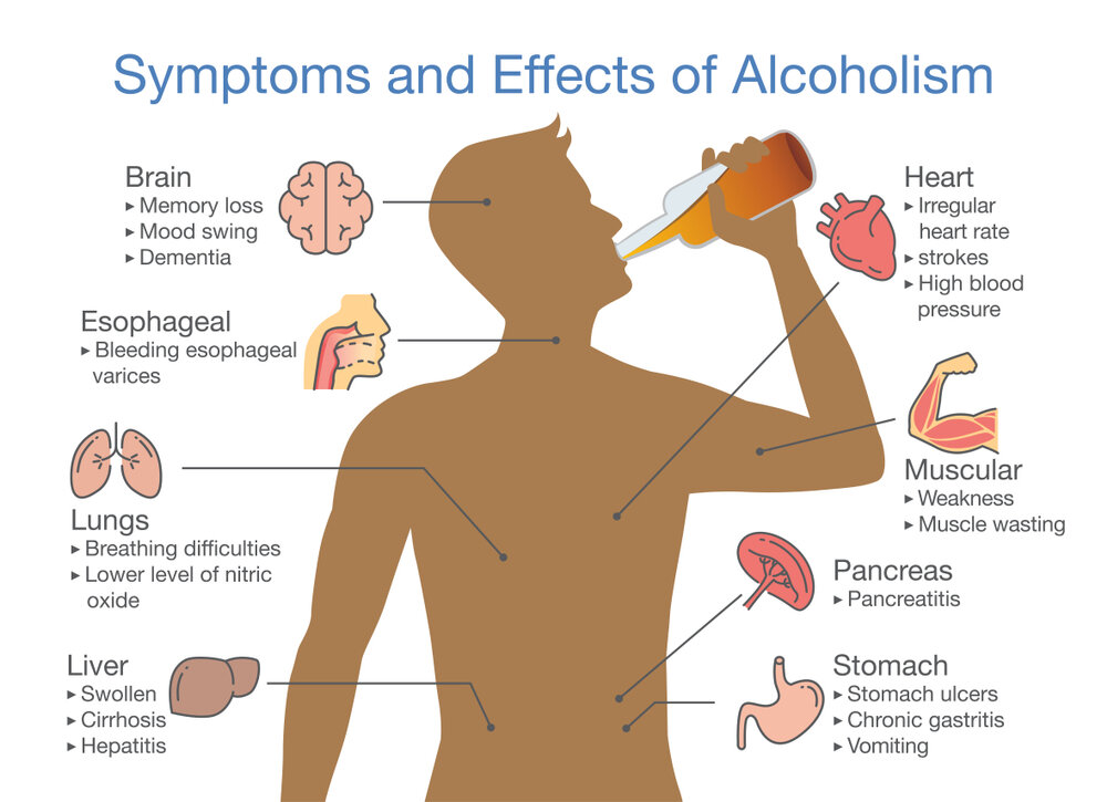 Symptoms and Effects of Alcoholism Symptoms and Effects of Alcoholism