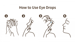 Directions for use of Restasis Eye Drops Directions for use of Restasis Eye Drops