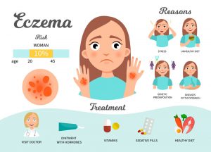 Eczema Treatment