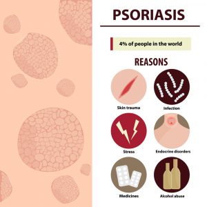 Psoriasis Causes