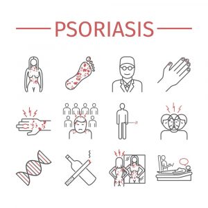 Psoriasis Signs