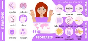 Psoriasis Treatment Psoriasis Treatment