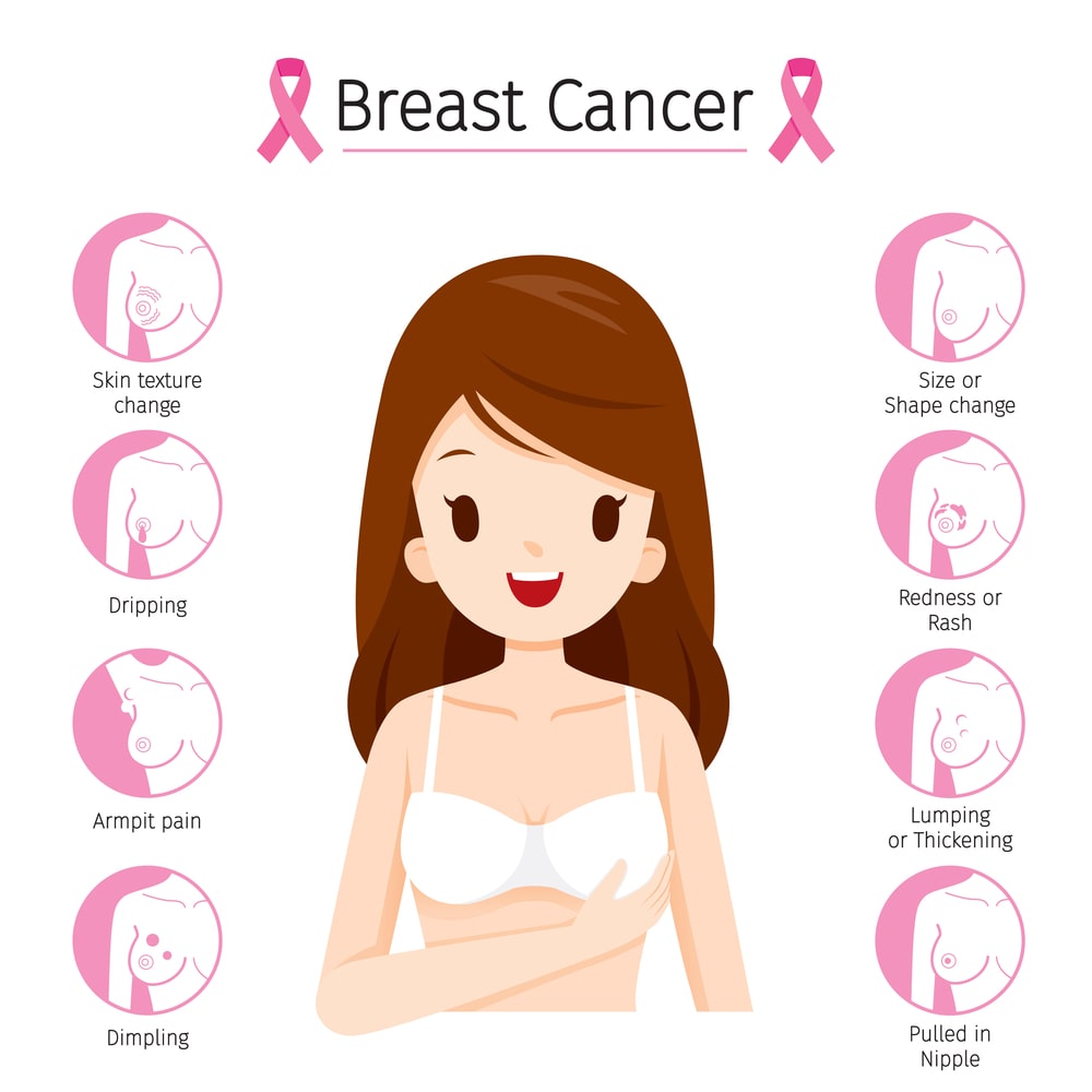 What are the signs of Breast Cancer?