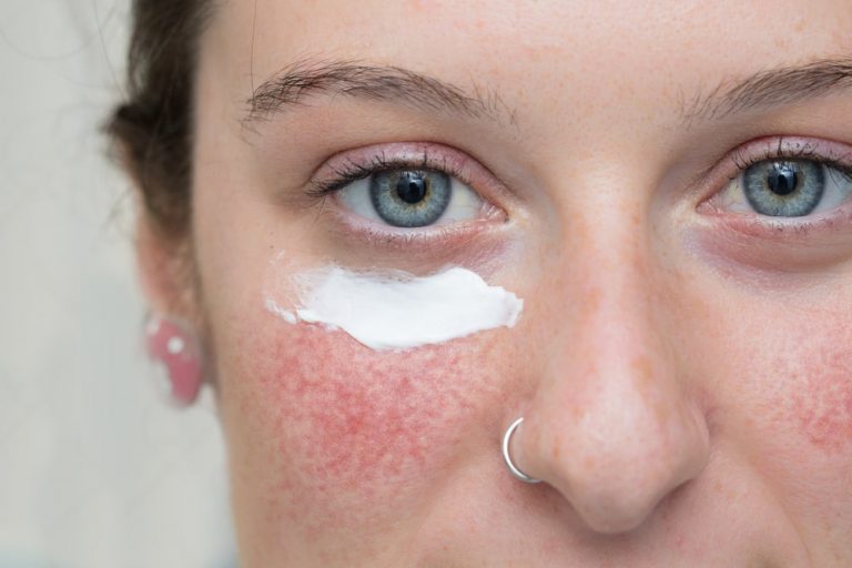 Why Is Soolantra So Expensive? Find Out More..