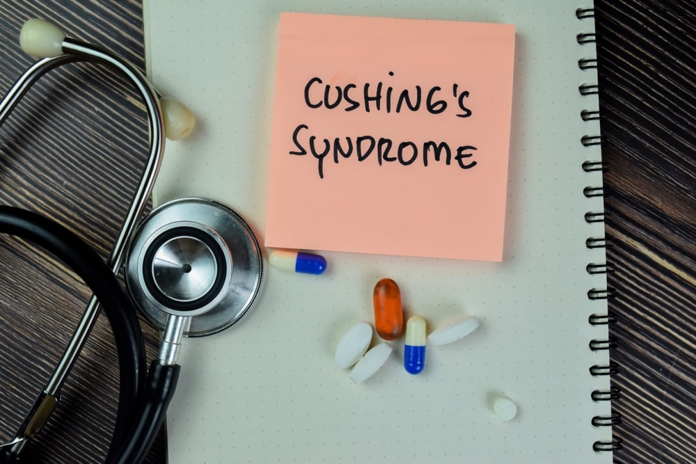 Is Cushing Syndrome Fatal? Find Out More...