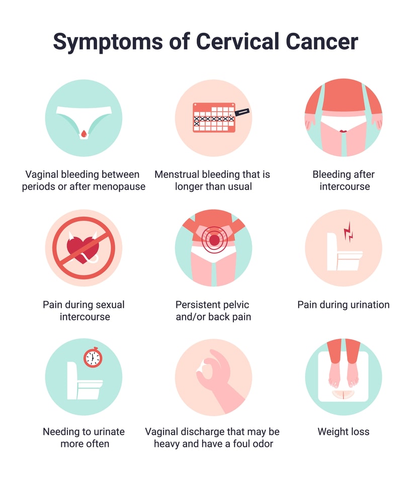 Signs of Cervical Cancer